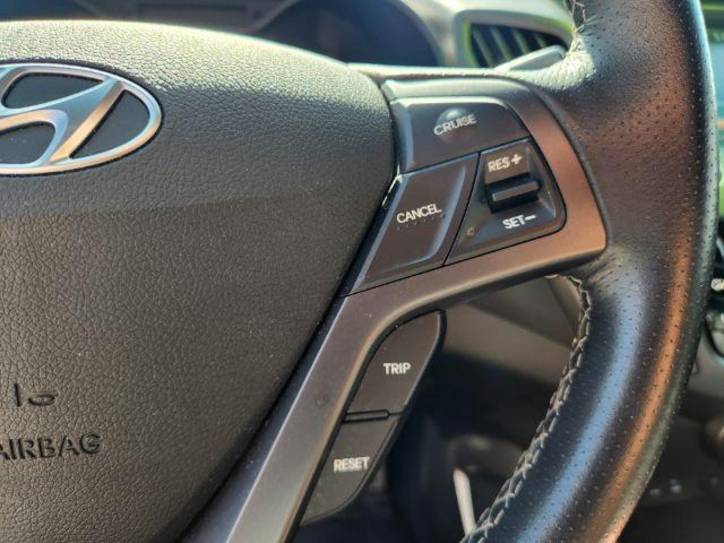 2017 Pacific Blue Pearl /Black Hyundai Veloster (KMHTC6AE0HU) with an 16L I-4 gasoline direct injection engine, Automatic transmission, located at 1175 N Woodruff Ave, Idaho Falls, ID, 83401, 43.506901, -111.999657 - At Timberline Auto, finding a great deal on your next vehicle is always easy! Our experienced sales staff's goal is to help find you the right vehicle at the right price! Our knowledgeable finance department has options for almost any credit score. We offer extended service contract options to prote - Photo#44